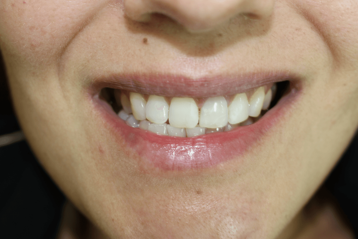 Estética dental responsable