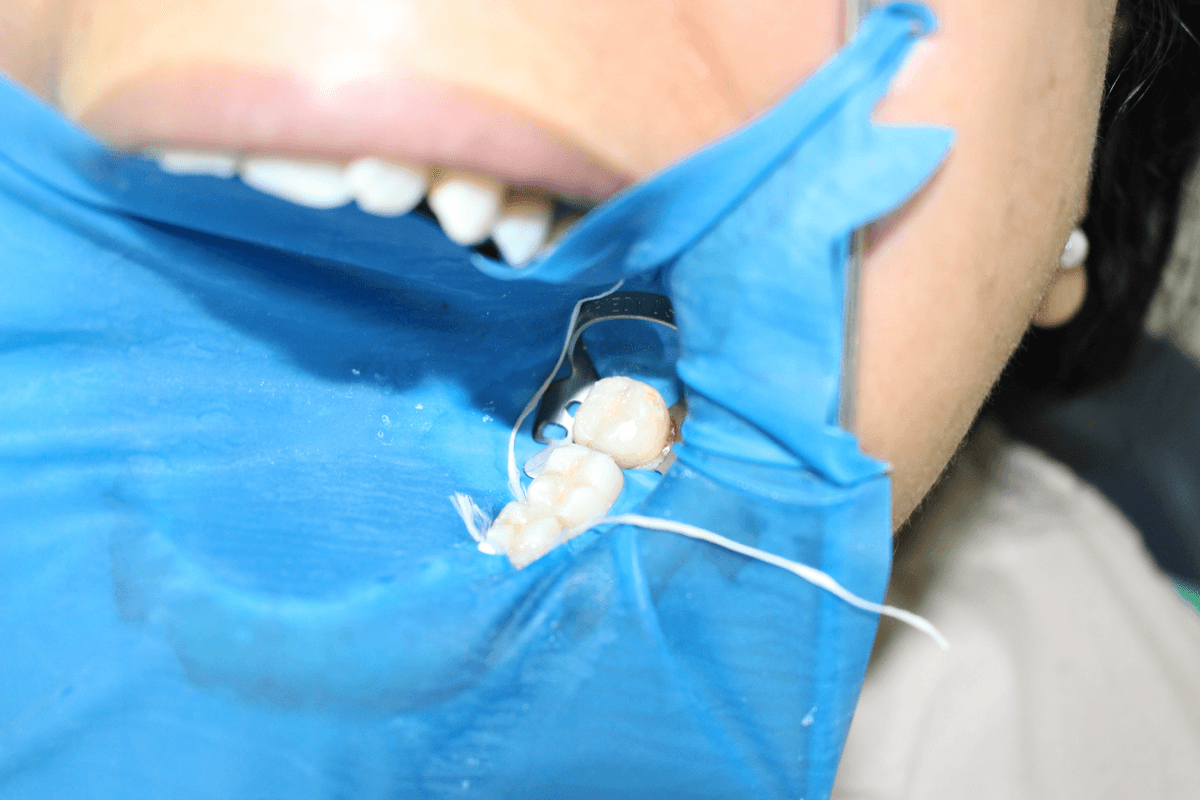 Oral rehabilitation planning